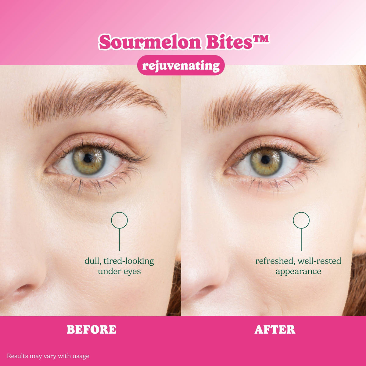 ESW Beauty - ESW x SmartSweets Rejuvenating Sourmelon Bites™ Eye Patches: 1 pc