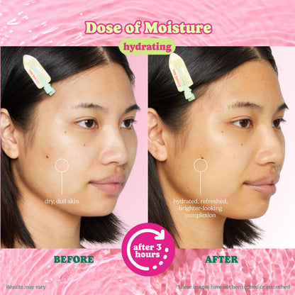 ESW Beauty - Dose of Moisture Hydrating Hydrogel PDRN Face Mask: 1 pc