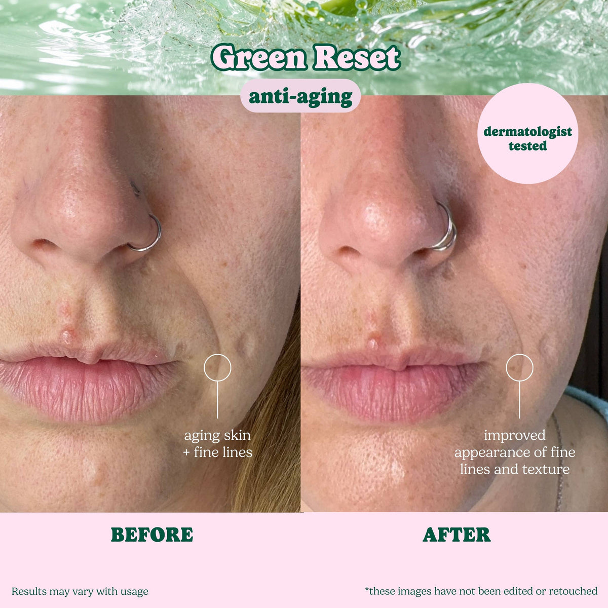 ESW Beauty - Evergreen Reset Anti-Aging Sheet Mask: 1 pc