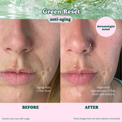 ESW Beauty - Evergreen Reset Anti-Aging Sheet Mask: 1 pc